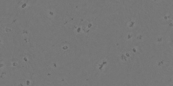 Micro2a
