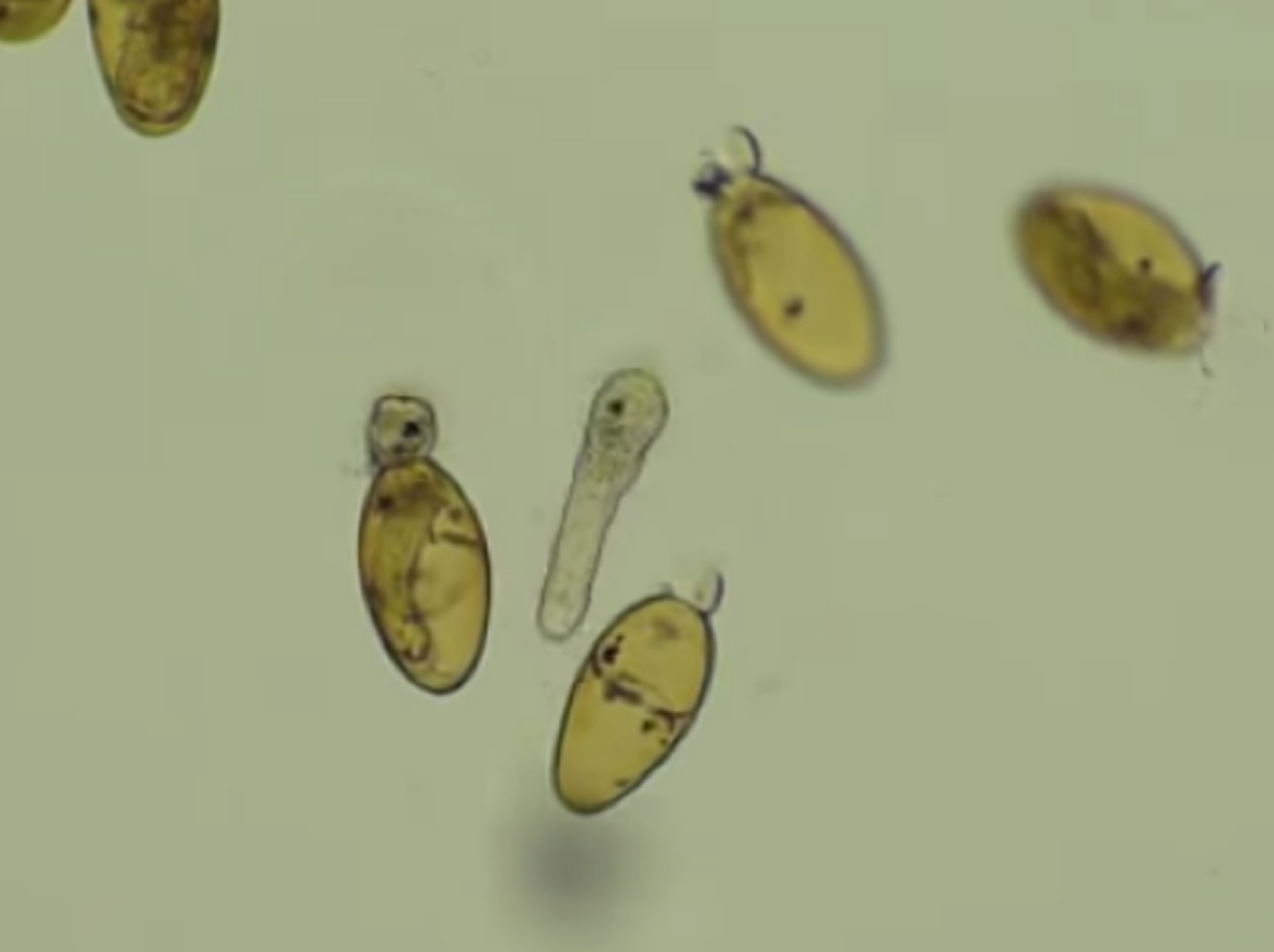 Fasciola