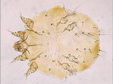 Scabies