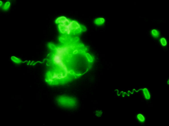 Microsporidia