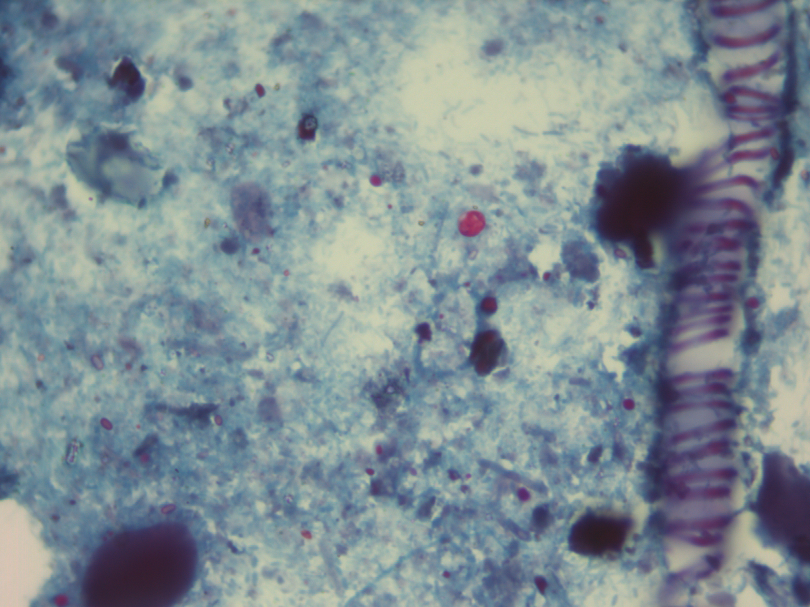 Cryptosporidium