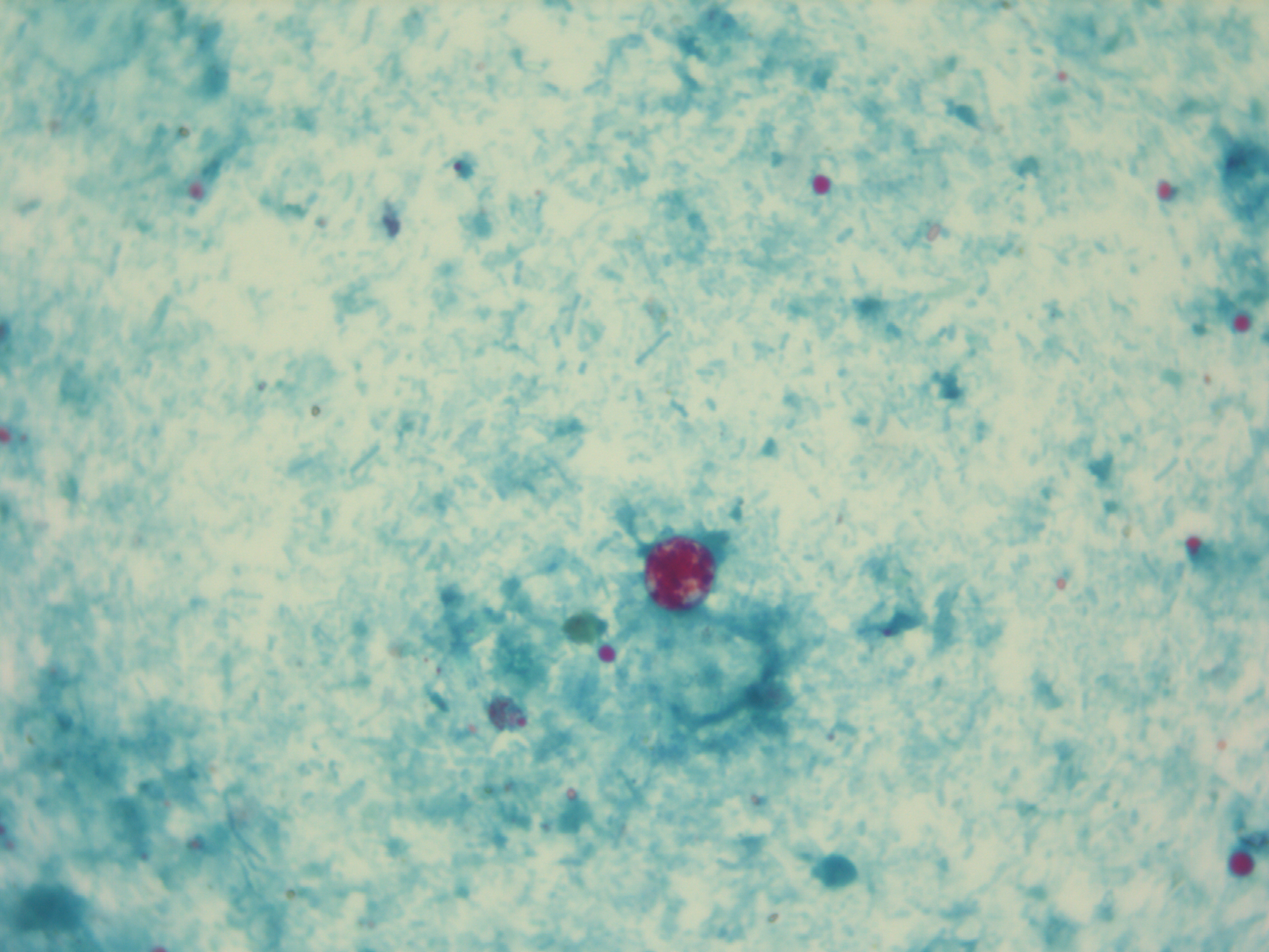 Cyclospora