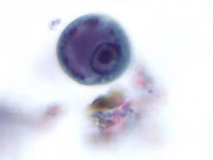 Entamoeba histolytica