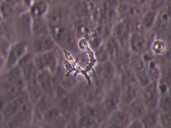 Free Living Amoeba