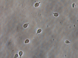 Giardiasis