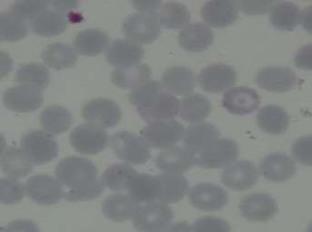 Plasmodium