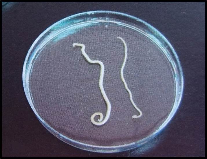 Toxocara