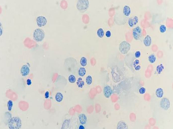 Toxoplasma gondii