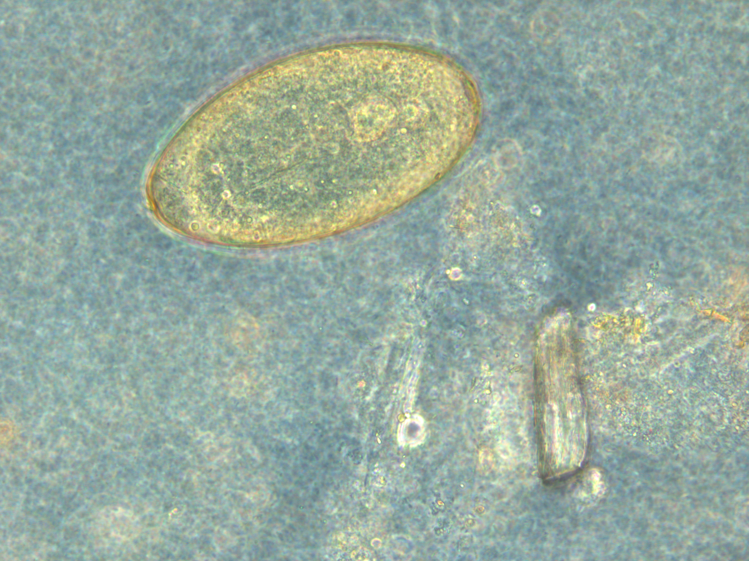 Example magnification of fasciola Sp
