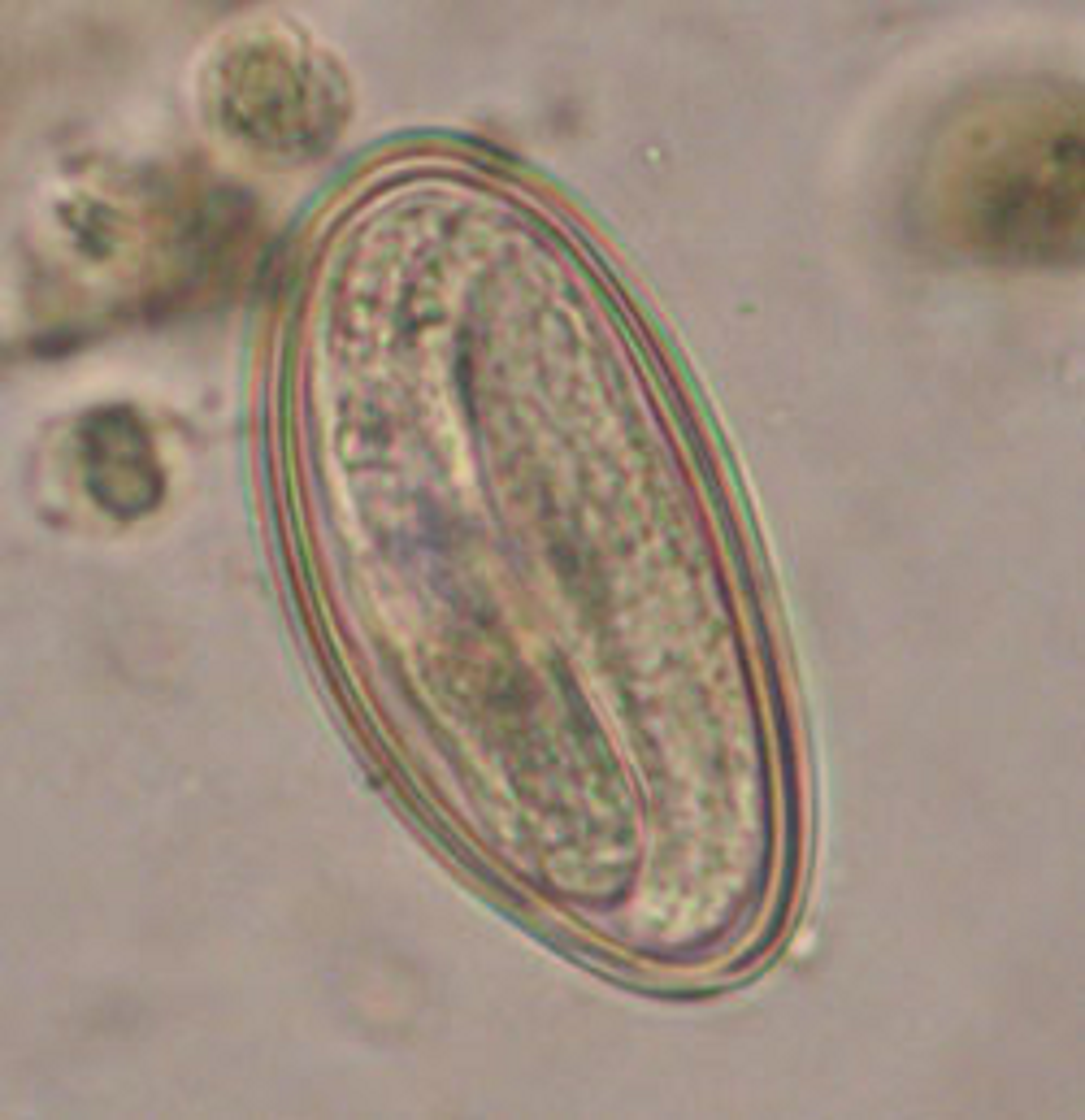 Enterobius