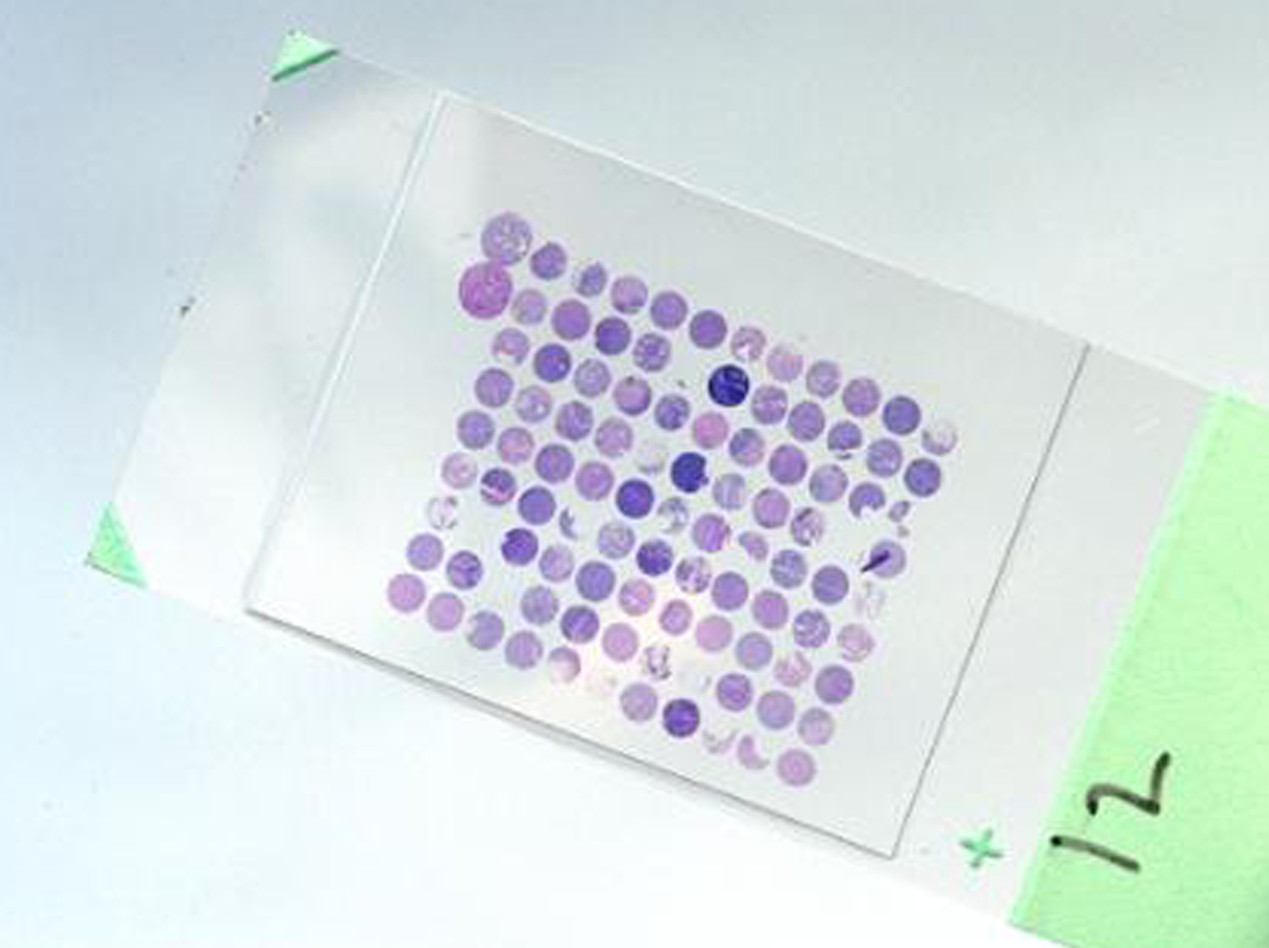Microarray