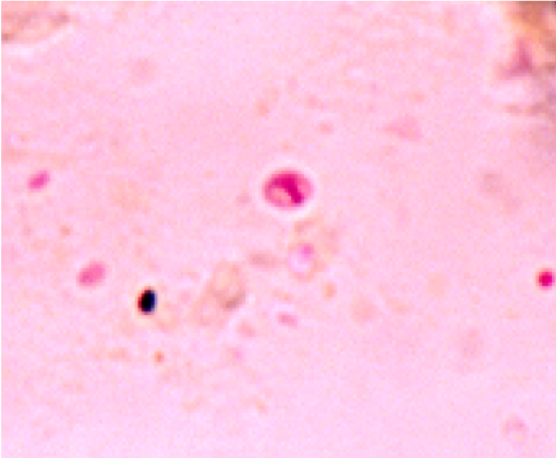 Trichrome