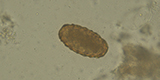 Ascaris lumbricoides