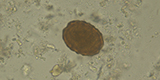 Ascaris lumbricoides