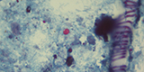 Cryptosporidia sp
