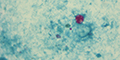 Cyclospora cayetanensis
