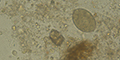 Diphyllobothrium latum