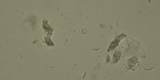 Endolimax nana