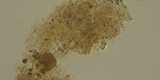 Echinococcus granulosus
