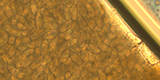 Enterobius vermicularis