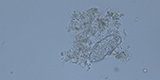 Enterobius vermicularis