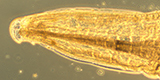 Enterobius vermicularis