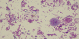 Giardia intestinalis