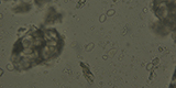 Giardia intestinalis