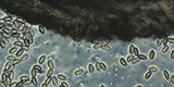 Enterobius vermicularis