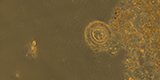 Hymenolepis nana