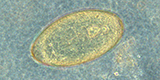 Fasciola sp