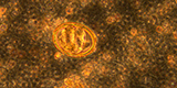 Ascaris lumbricoides