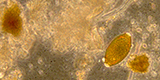 Trichuris trichiura