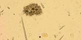 Plant cells and plant hairs