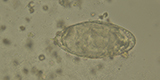 Schistosoma haematobium