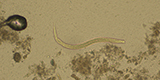 Strongyloides stercoralis