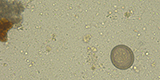 Taenia sp