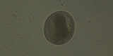 Toxocara canis