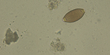 Trichuris trichiura