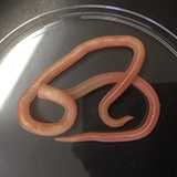 Ascaris lumbricoides