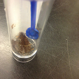 Enterobius vermicularis
