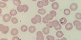 Plasmodium falciparum