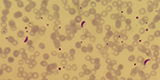 Plasmodium falciparum
