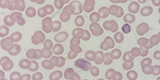Plasmodium malarie