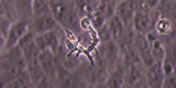 Balamuthia trophozoite on Vero E6 cells