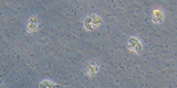 Naegleria fowleri trophozoites in culture