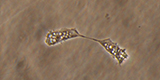 Acanthamoeba trophozoites in division