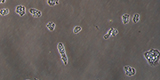 Acanthameoba trophozoites in culture