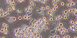 Acanthamoeba Cyst and trophozoites in culture