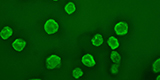 Acanthamoeba trophozoites